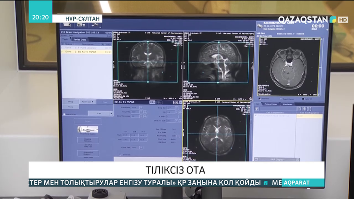 20-ға жуық қазақстандыққа «Гамма-пышақ» қондырғысымен операция жасалды