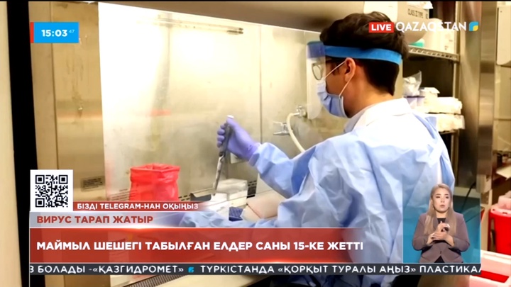 Әлемде маймыл шешегі табылған елдер саны 15-ке жетті
