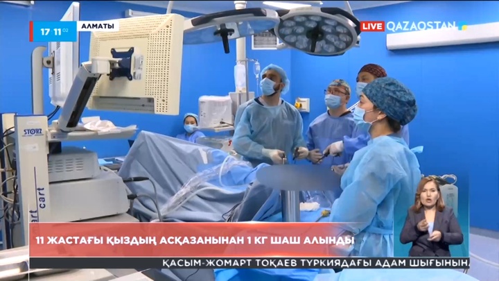Алматыда 11 жастағы қыздың асқазанынан 1 кг шаш алынды