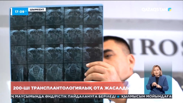 Шымкентте 200-ші бүйрек ауыстыру операциясы жасалды