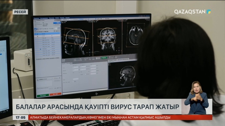 Ресейде қауіпті «коксаки» вирусы өршіп барады