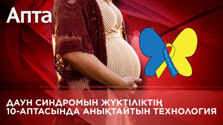 Елімізге Даун синдромын жүктіліктің 10-аптасында анықтайтын технология келді