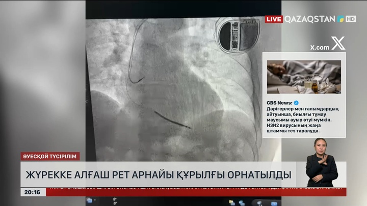  Алматыда жүрекке алғаш рет арнайы құрылғы орнатылды