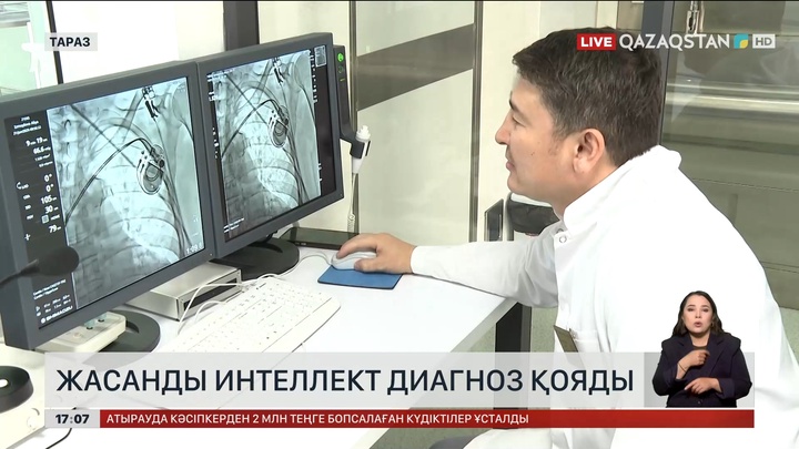Енді жамбылдық тұрғындарға жасанды интеллект диагноз қояды