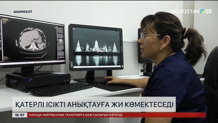 Қатерлі ісікті анықтауға ЖИ көмектеседі