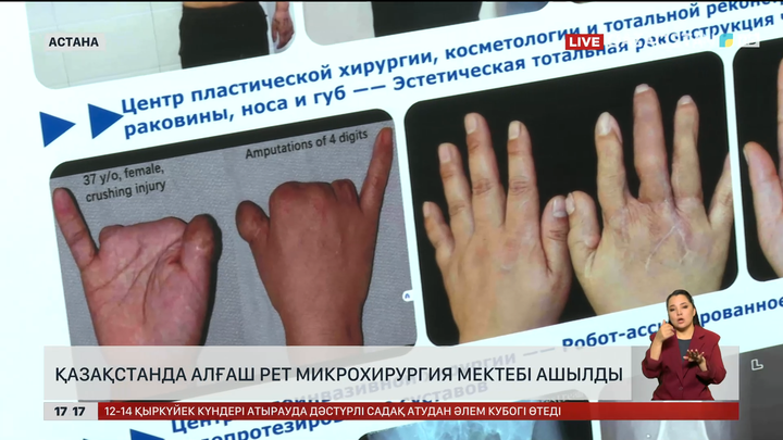 Қазақстанда микрохирургия мектебі бірінші рет ашылды