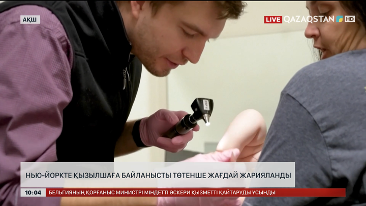 Нью-Йоркте қызылшаға байланысты төтенше жағдай жарияланды
