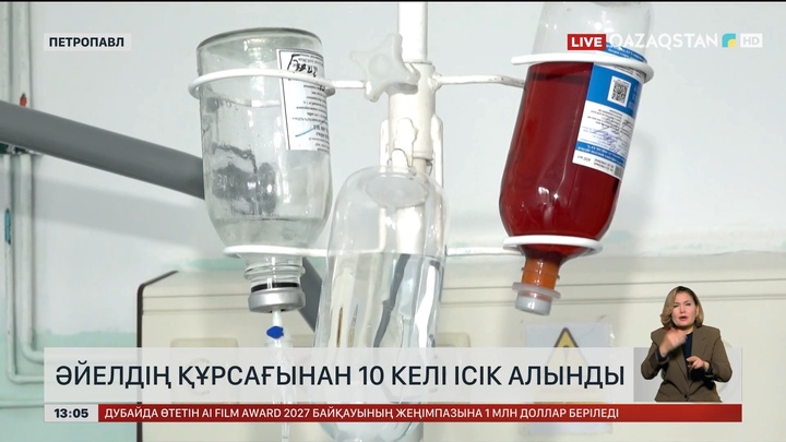 Петропавлда дәрігерлер әйелдің құрсақ қуысынан 10 келілік ісікті алып тастады