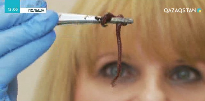 Жауын құрттары келешекте қатерлі ісікті емдеуге пайдаланылуы мүмкін