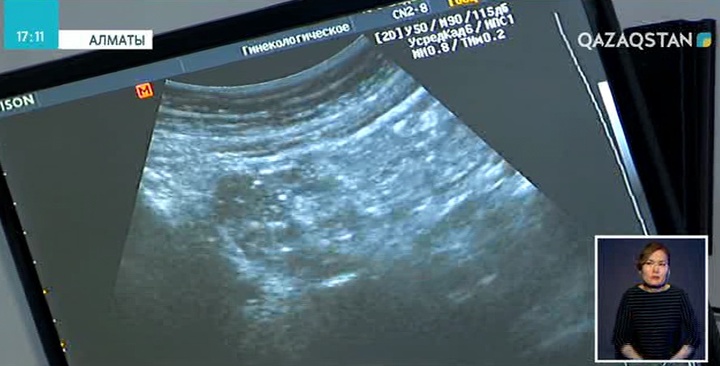 Бедеулікке әкеп соқтырып жатқан жаңа себеп – отбасын кеш құру