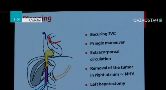 Елімізде ішкі ағзалардың доноры тапшы
