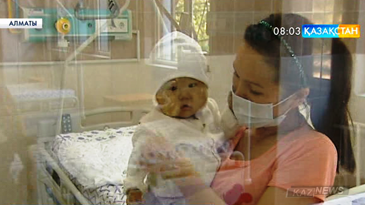 А.Сызғанов атындағы Ұлттық хирургия ғылыми орталығында екі баланың бауырына трансплантация жасалды