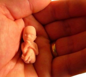 Абортқа қарсы шеру өтті