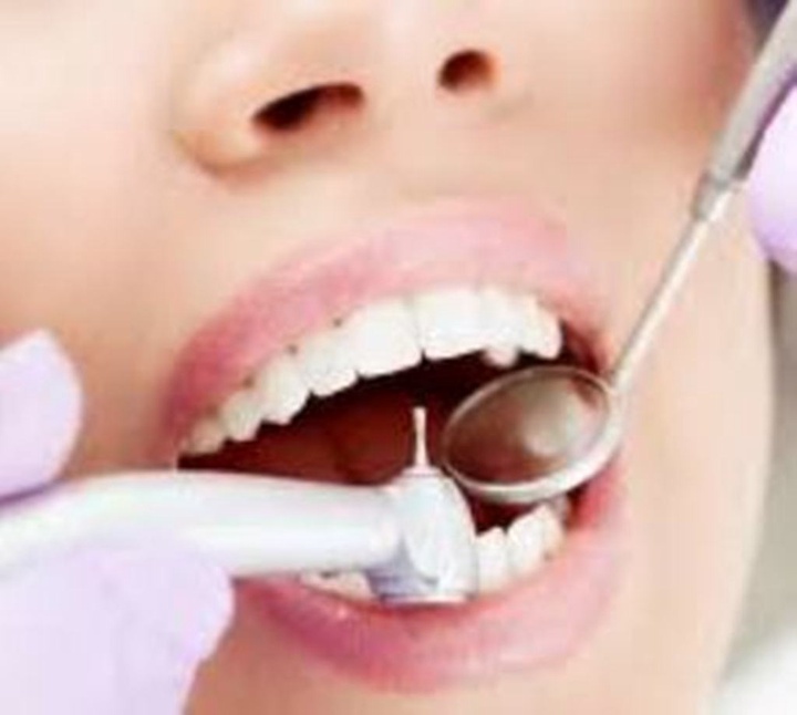 Ғалымдар тісті емдеудің жаңа технологиясын ойлап тапты