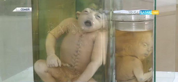 Атом сынақтары жасалған кезде халықтың денсаулығы құпия түрде зерттелген