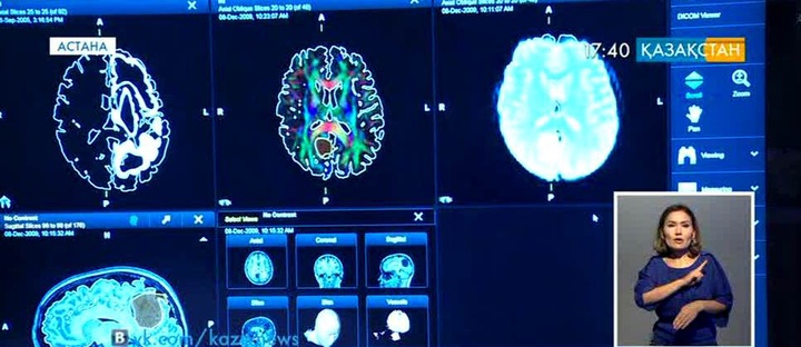 Елордада нейрохирургтердің Х Азиялық конгресі жалғасуда