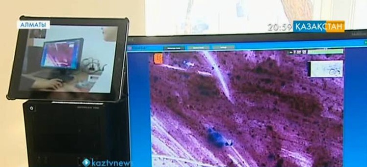 Қазақстанда телепатологияның инновациялық тәсілі енгізілді