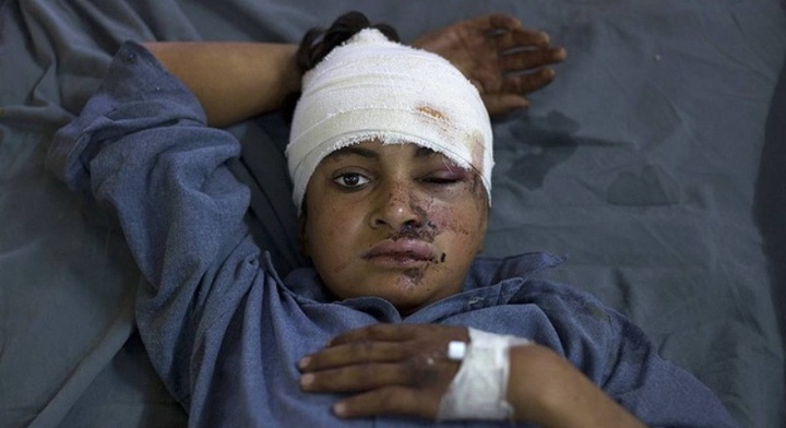 Пәкістандық мешіттердің бірінде жанкешті өзін-өзі жарып жіберді